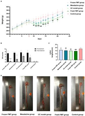 Effects of Different Treatment of Fecal Microbiota Transplantation Techniques on Treatment of Ulcerative Colitis in Rats